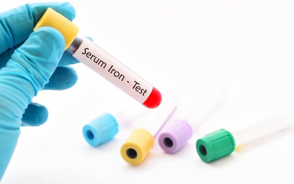 Endometriosis and low ferritin levels