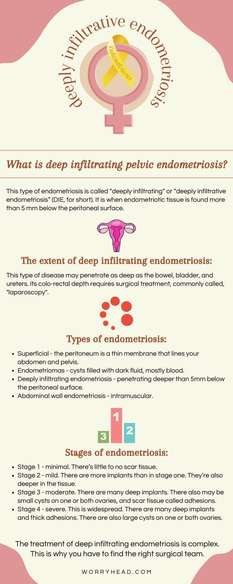 What is deep infiltrating pelvic endometriosis infographic