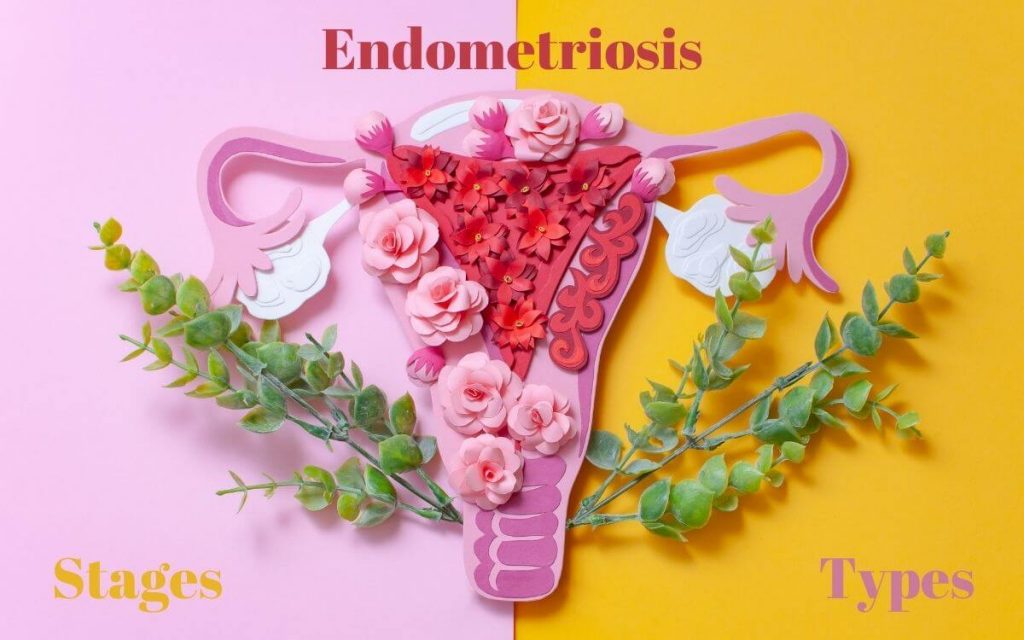 Will endometriosis kill you 1