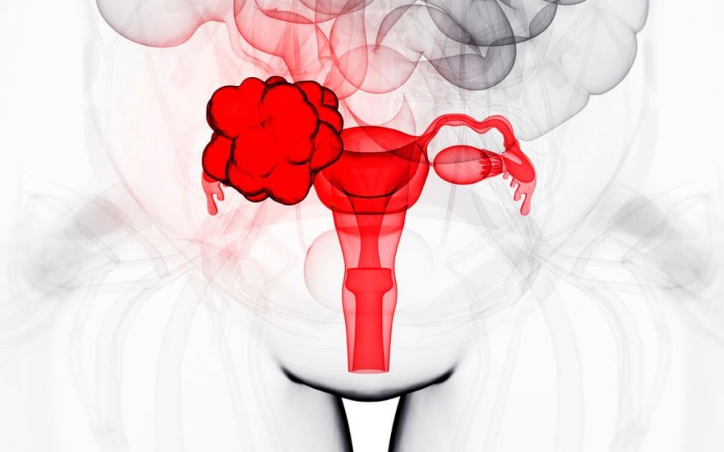 Men of women with endometriosis 1