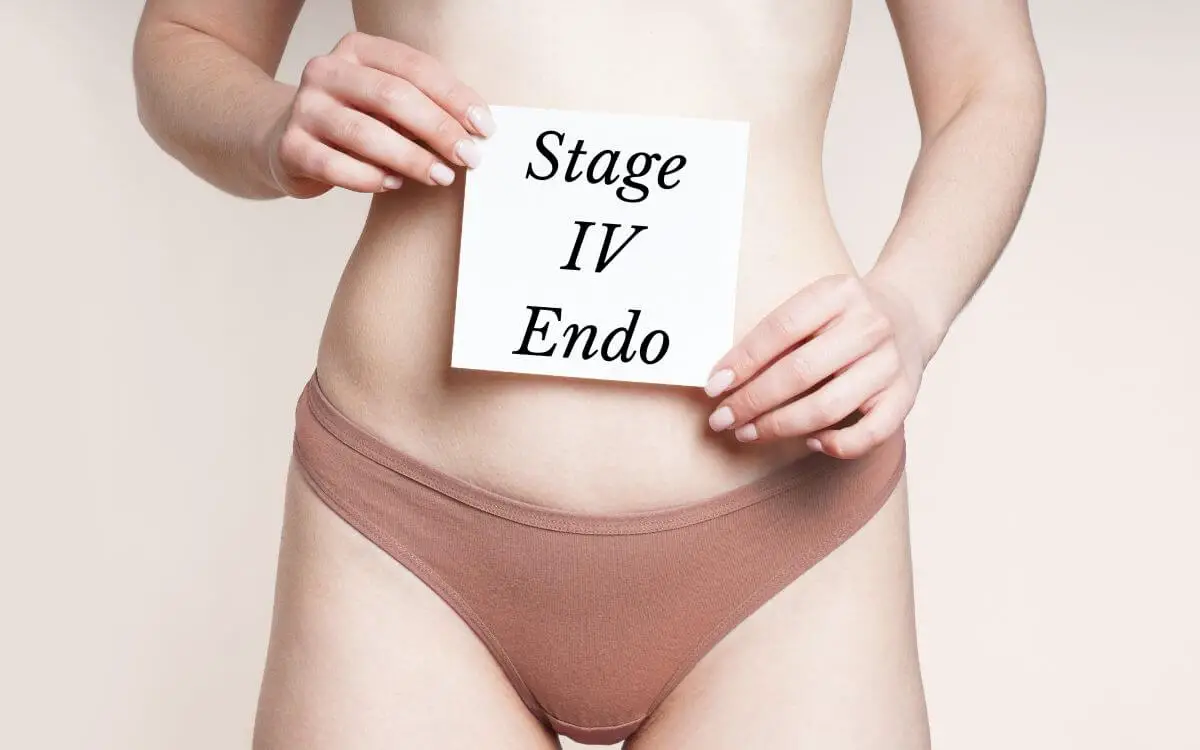 Stage 4 endometriosis